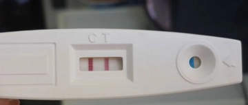 Hamilelikte İdrar Testi Nasıl Yapılır?