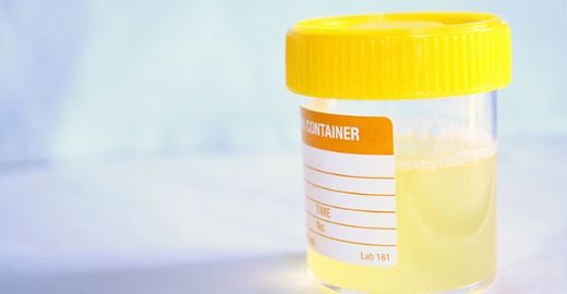 İdrar Yolu Enfeksiyonu Kaç Günde Geçer?