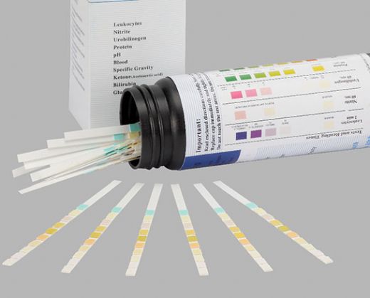 İdrarda Keton Belirtileri ve Tedavisi