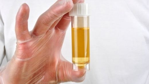 İdrardan Meni Gelmesi Nedenleri?